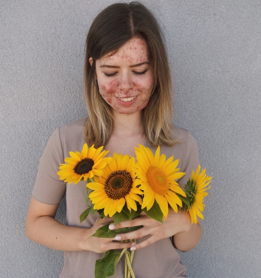 Bianca hält einen Strauß Sonnenblumen, auf den sie lächelnd hinunterschaut.